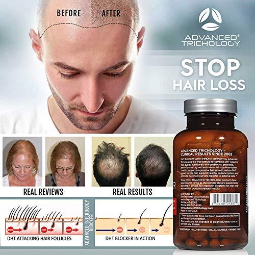 Advanced Trichology DHT Blocker with Immune Support Hair Loss